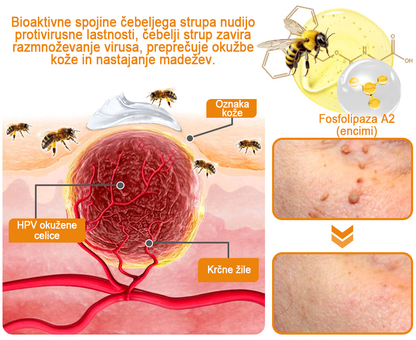 🍯👑𝐁𝐄𝐍𝐄𝐓𝐔𝐑𝐄™ Čebelji strup za odstranjevanje bradavic in madežev (razprodaja zadnjega dne, 80 % popust)